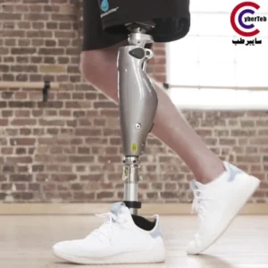 مفصل پروتز هوشمند C-Leg اتوبوک آلمان