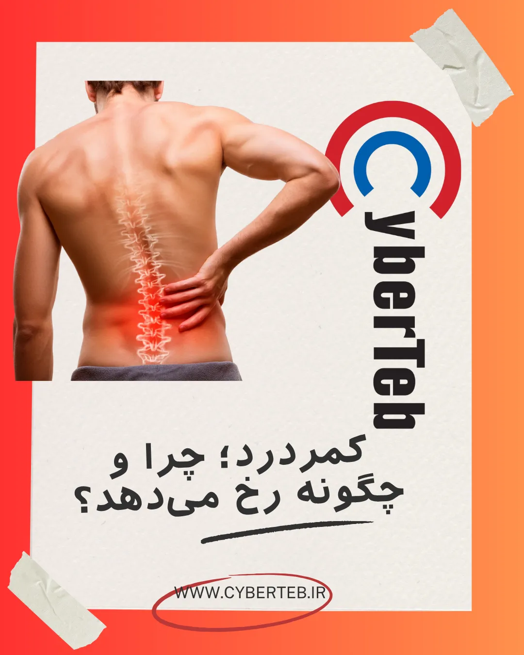 کمردرد درمان غیر جراحی