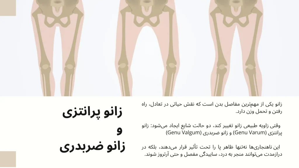 زانو پرانتزی و زانو ضربدری