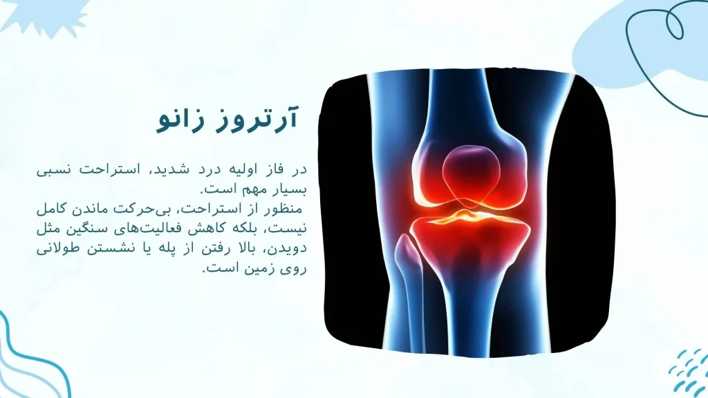 درمان زانو درد شدید