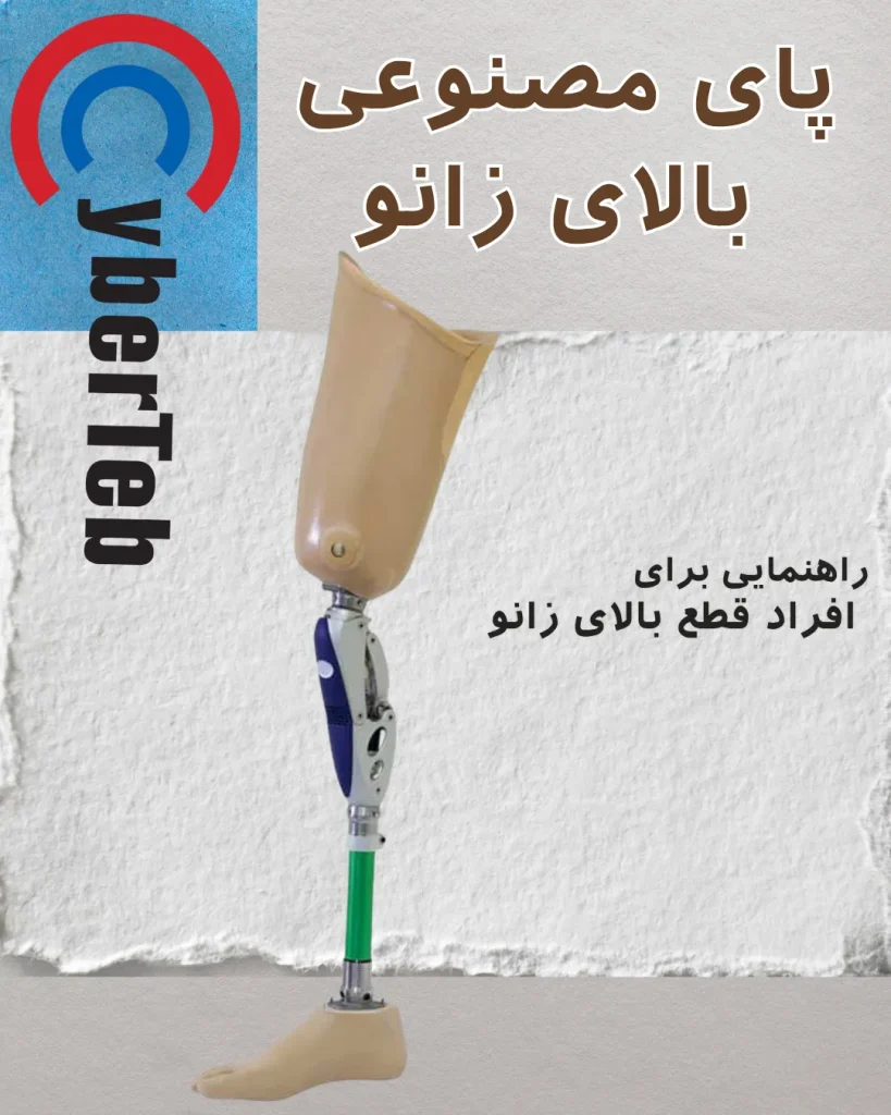 پای مصنوعی بالای زانو