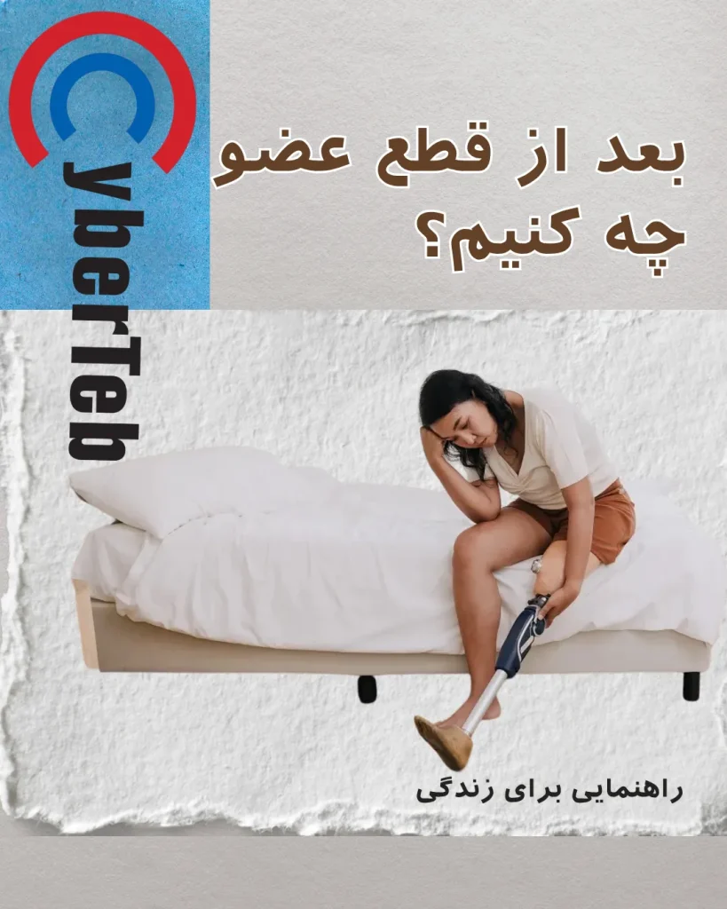 قطع عضو