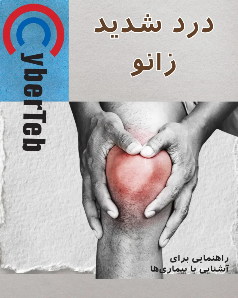 درمان زانو درد شدید