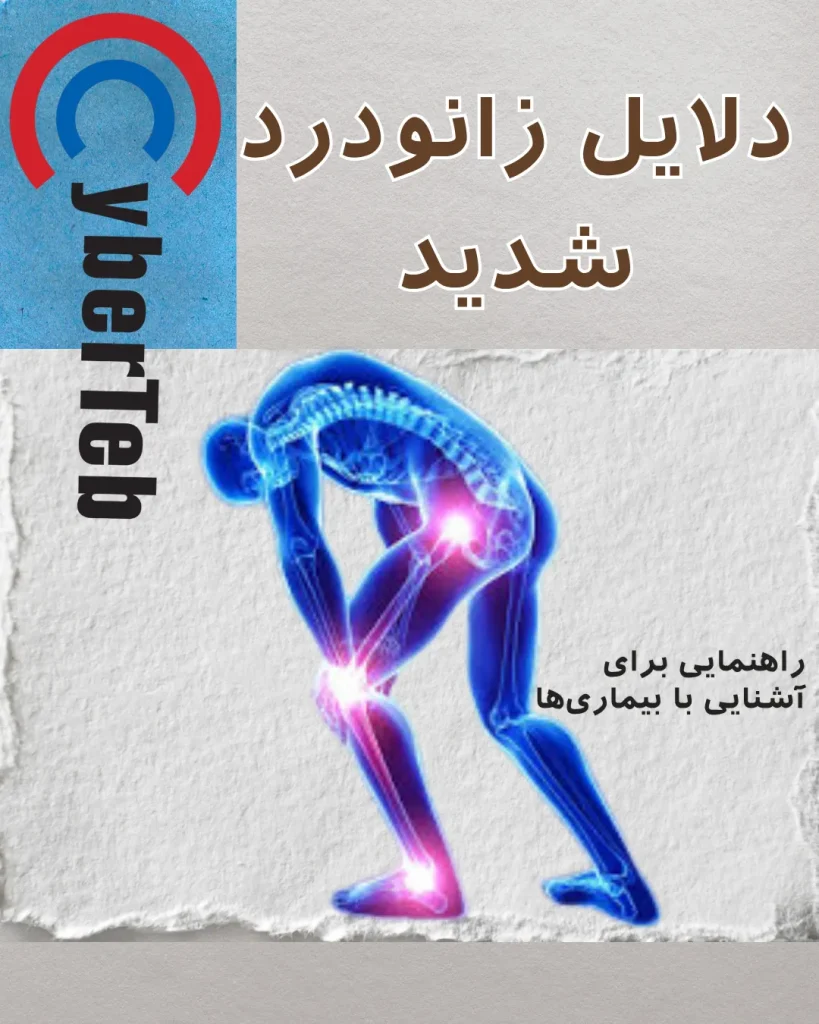 زانودرد شدید