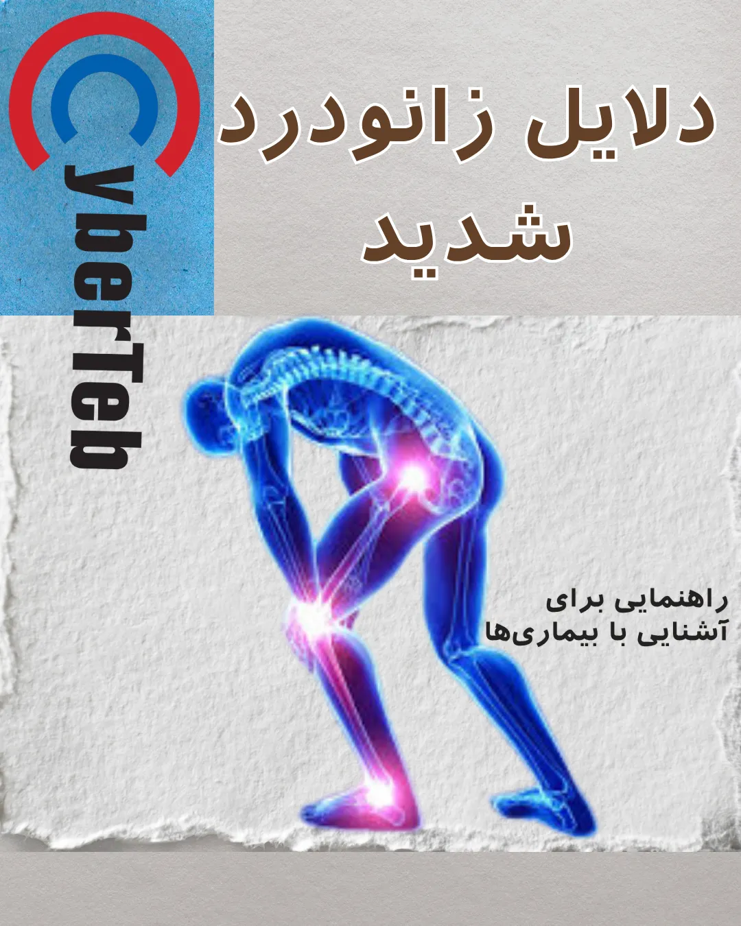 زانودرد شدید