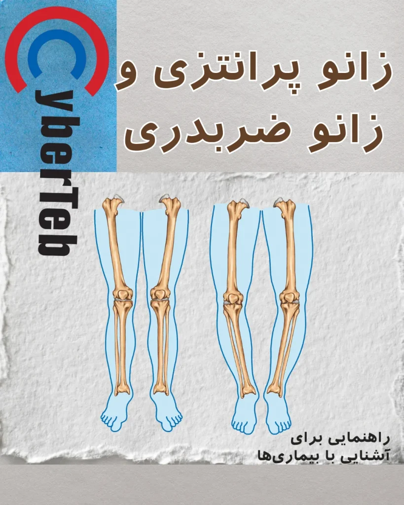 زانو پرانتزی و زانو ضربدری