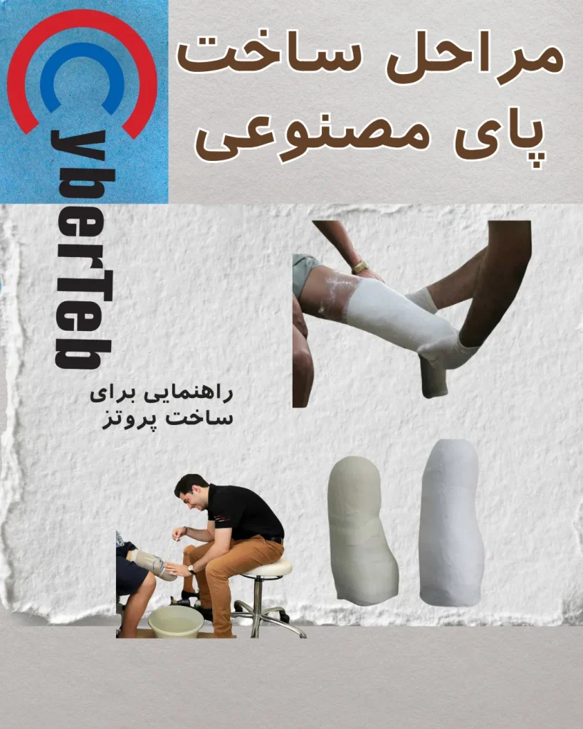 ساخت پای مصنوعی