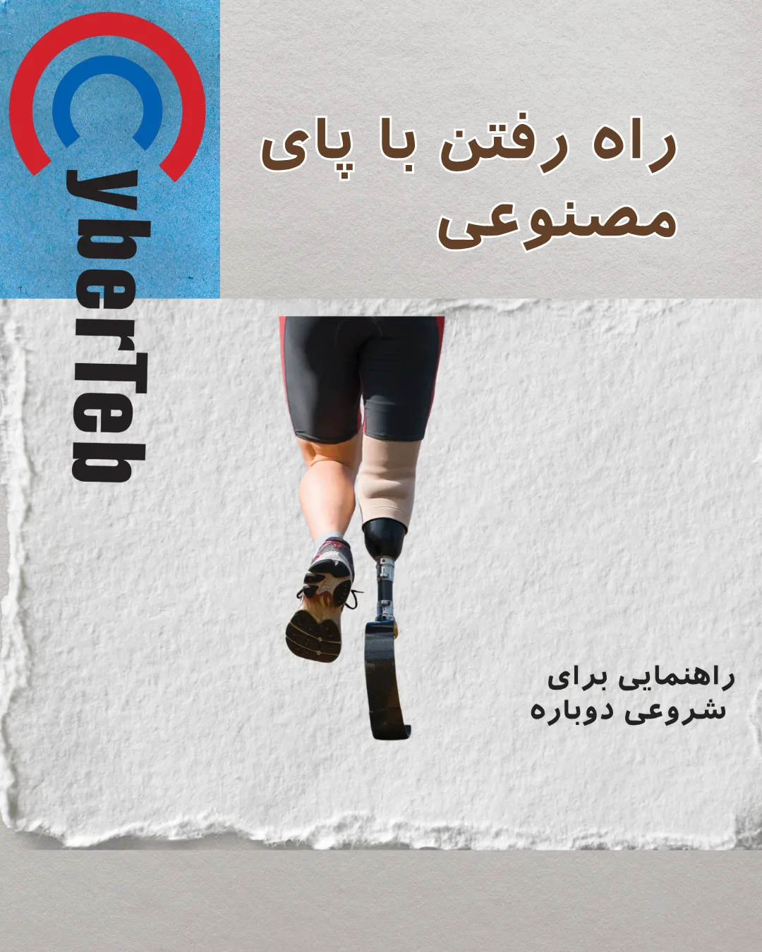 زندگی با پروتز