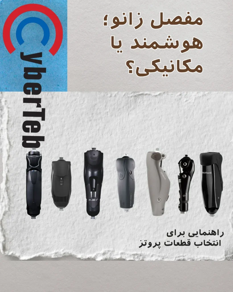مفصل هوشمند زانو چه تفاوتی با مفصل مکانیکی دارد؟ در این مقاله با ساختار، عملکرد، مزایا و نحوه‌ی انتخاب بهترین مفصل زانوی مصنوعی آشنا شوید. کلینیک سایبرطب تأمین‌کننده مفاصل هوشمند و مکانیکی از برندهای اتوبوک آلمان و اوسر آمریکا است.