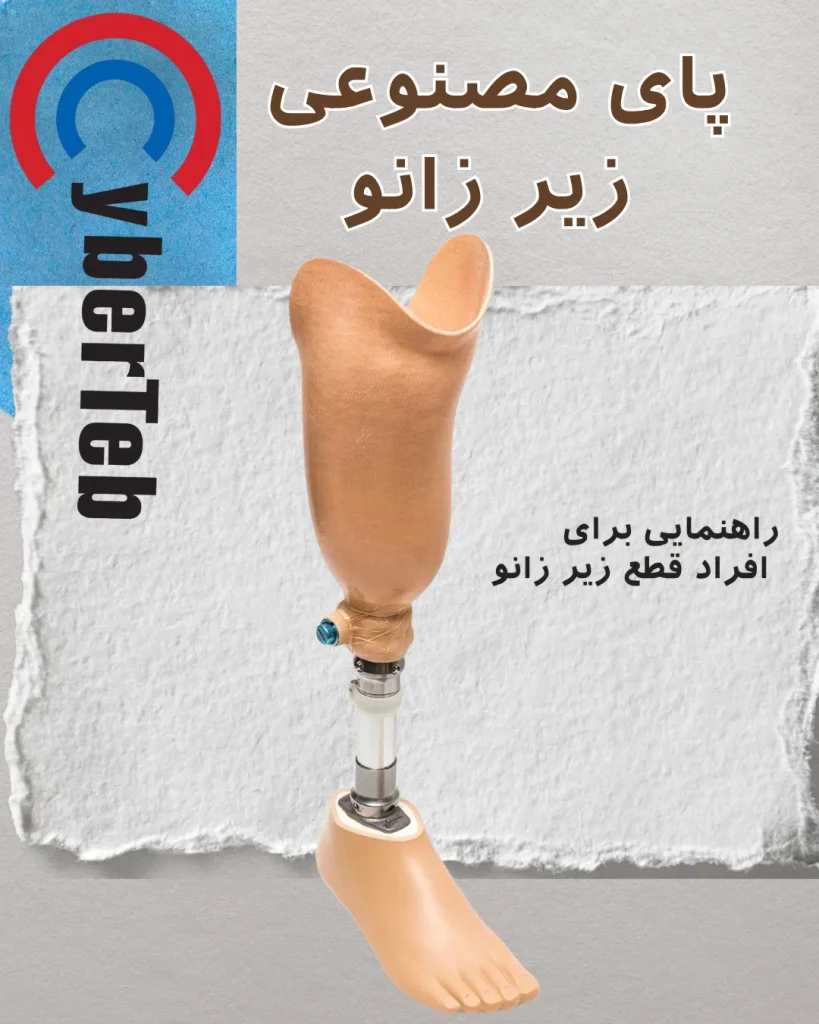 پای مصنوعی زیر زانو