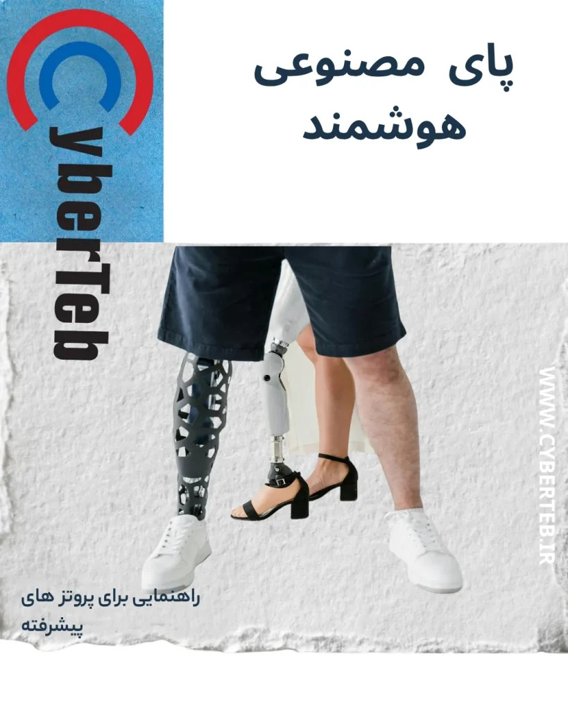 پای مصنوعی هوشمند