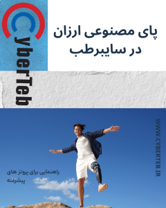 پای مصنوعی دست دوم