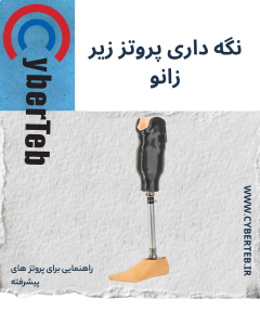 پروتز زیر زانو