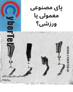 پروتز ورزشی