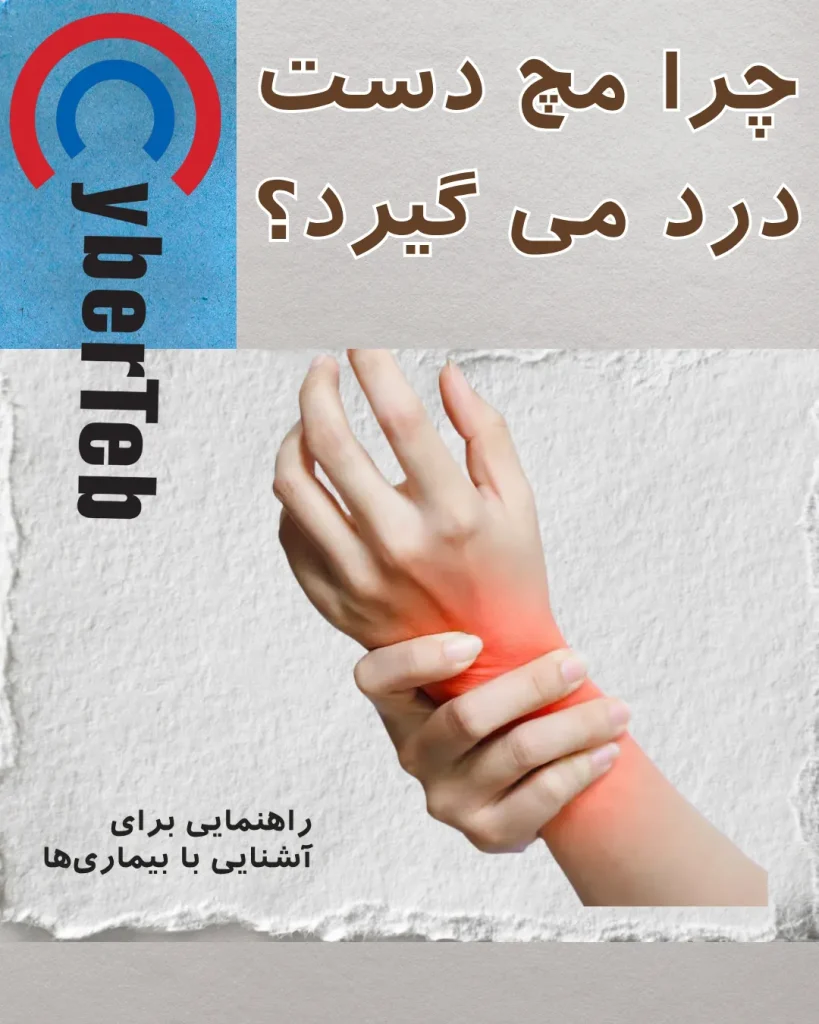 مچ دست