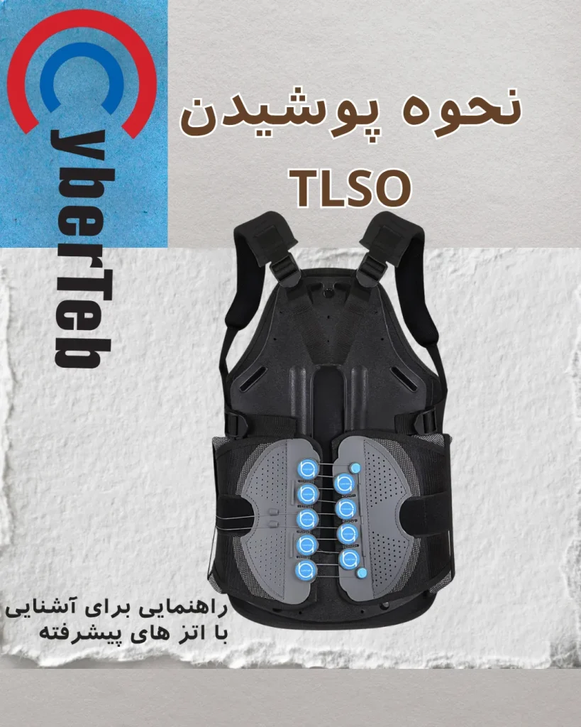 کمربند TLSO