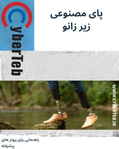 پای مصنوعی زیر زانو