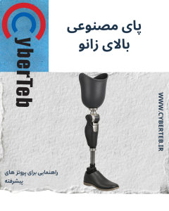 پای مصنوعی بالای زانو