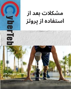 پای مصنوعی