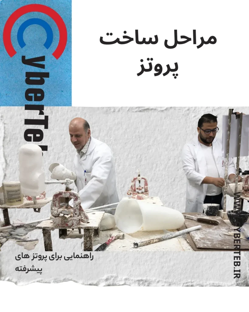 پروتز زیر زانو