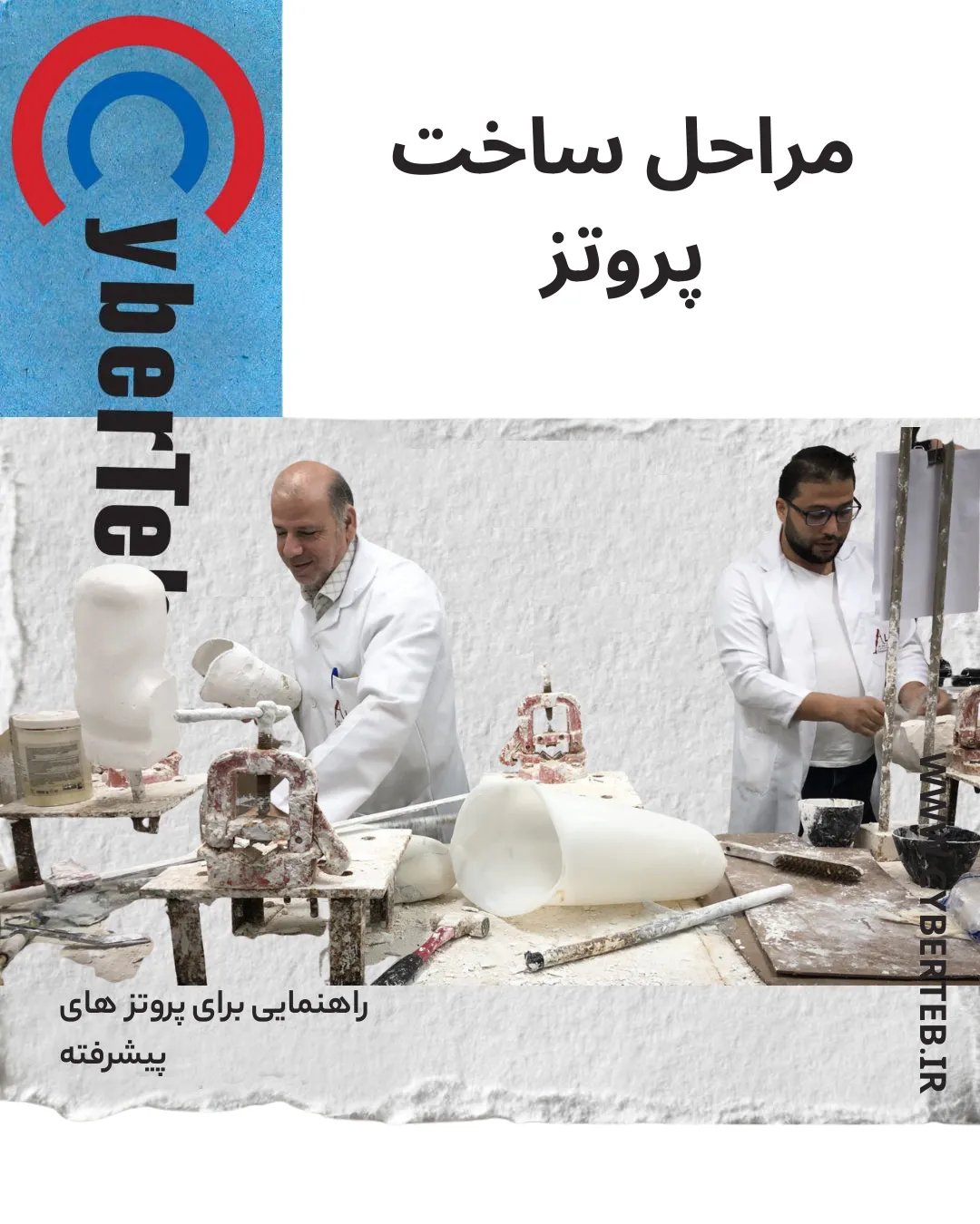 پروتز زیر زانو