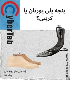 پای مصنوعی کربنی
